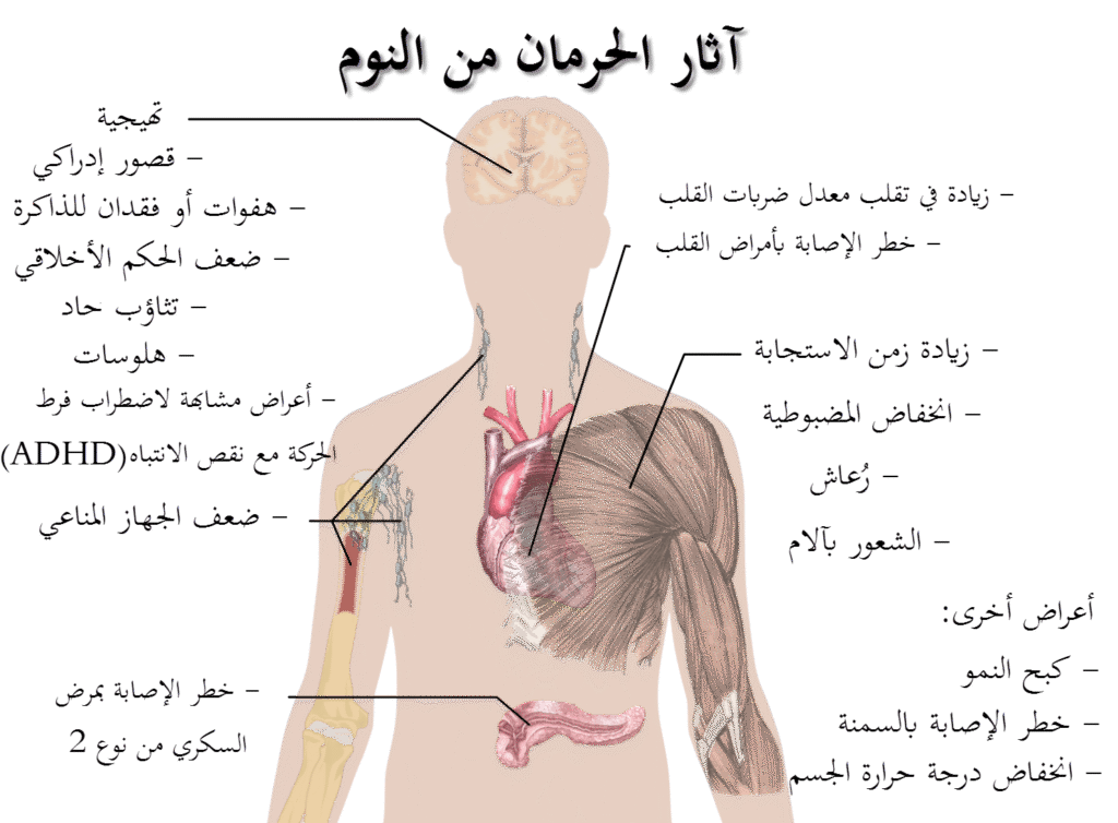 أضرار قلة النوم